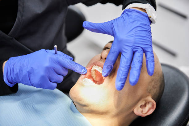 Best Emergency Dental Care for Broken or Chipped Teeth in Country Lake Estates, NJ